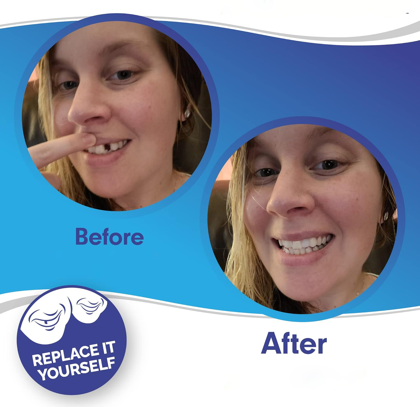 Veneers For Upper And Lower Teeth — Instant Smile Removable Set