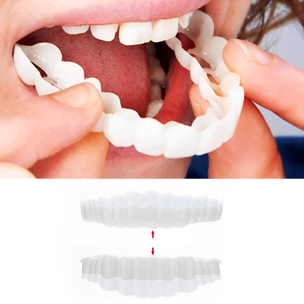 Veneers For Upper And Lower Teeth — Instant Smile Removable Set