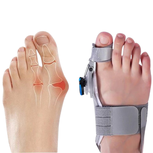 Toe Spacer Natural Gel For Bunion Relief And Toe Alignment