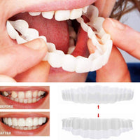 Veneers For Upper And Lower Teeth — Instant Smile Removable Set