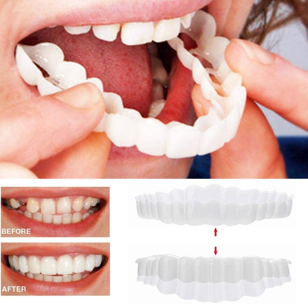 Veneers For Upper And Lower Teeth — Instant Smile Removable Set