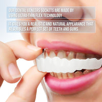 Veneers For Upper And Lower Teeth — Instant Smile Removable Set