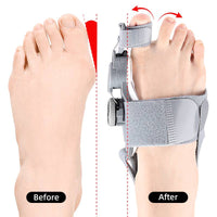Toe Spacer Natural Gel For Bunion Relief And Toe Alignment