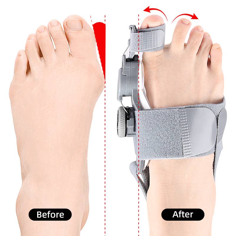 Toe Spacer Natural Gel For Bunion Relief And Toe Alignment